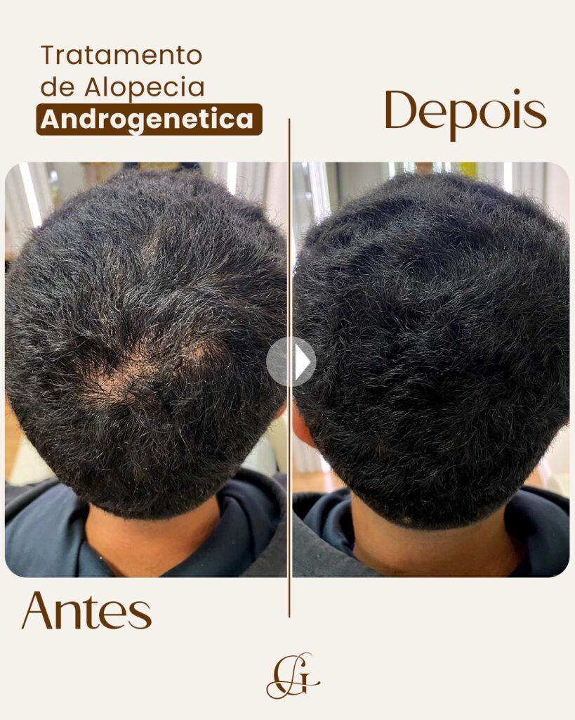 Gislene - posicionamento-7